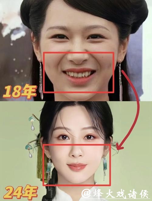 微博之夜上，我感觉杨紫的颜值完胜辛芷蕾。以前杨紫是娃娃脸，颜值平平。但这次微博之夜，她实现了完美逆袭